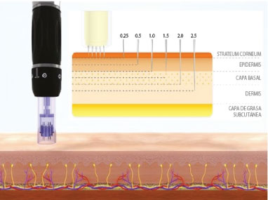 Dermapen Viva Dermoestética